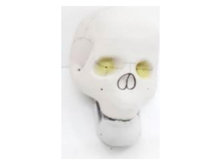 Human Skull (MGE-1697)
