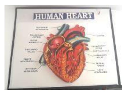 Human Heart (LED Working Model 16" × 19") (MGE-1760)