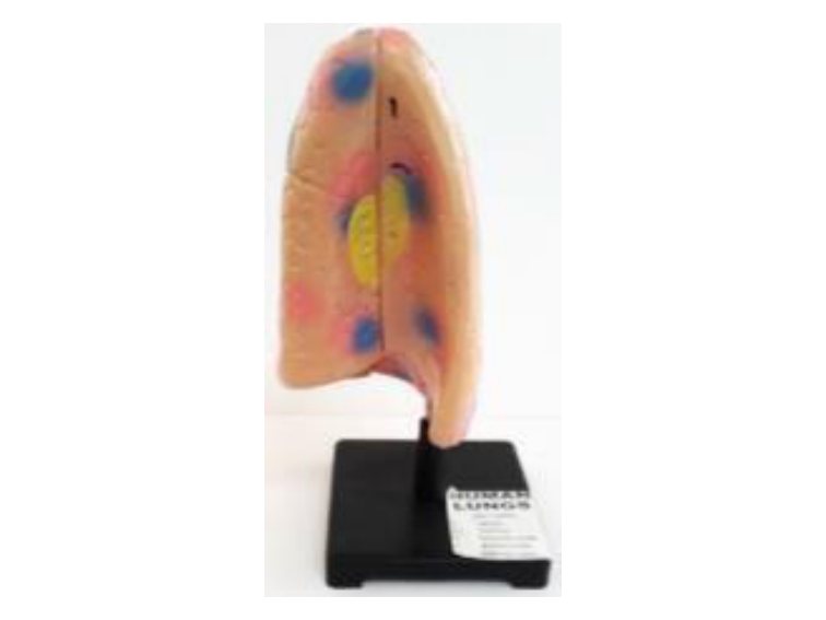Human Lungs (MGE-1765)